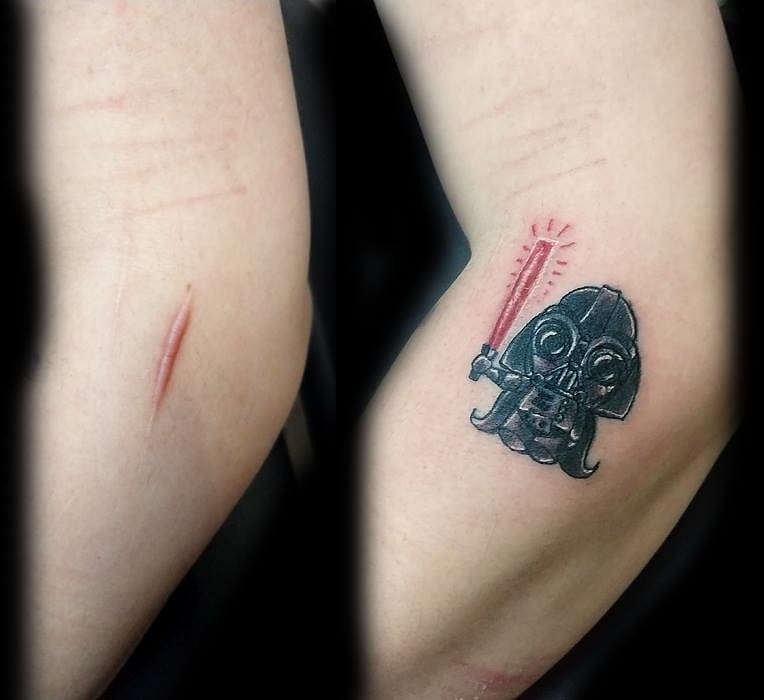 See how these creative people have hide their scars through tattoos 1
